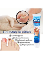 Load image into Gallery viewer, Crème réparatrice pour ongles Sumifun
