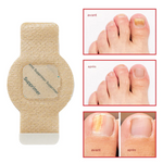 Load image into Gallery viewer, Pansements antifongiques pour ongles 01 Acheter = 01 Offert
